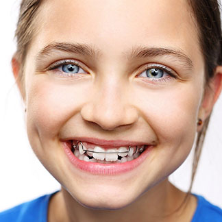 orthodontic retention