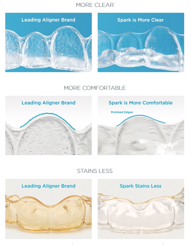 Invisalign cost